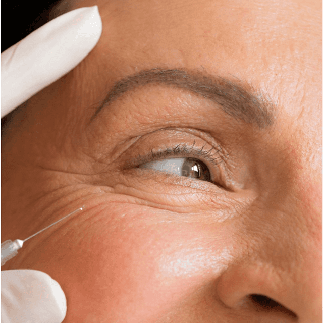 Smooth & Snatched - FULL Face