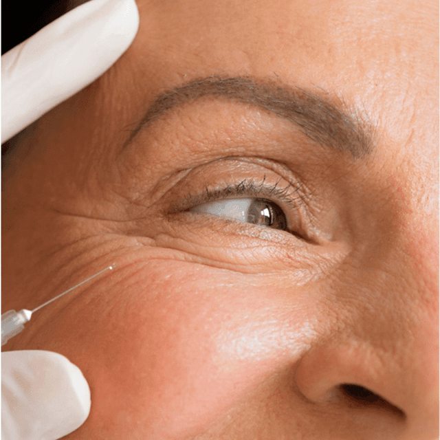 Smooth & Snatched - UPPER Face